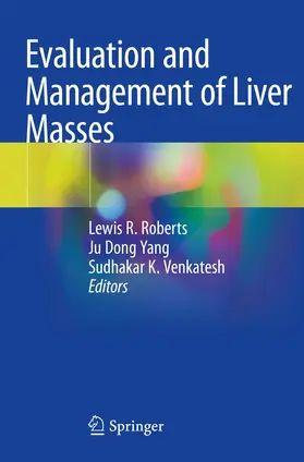 Roberts / Yang / Venkatesh |  Evaluation and Management of Liver Masses | Buch |  Sack Fachmedien