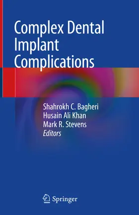 Bagheri / Khan / Stevens |  Complex Dental Implant Complications | eBook | Sack Fachmedien