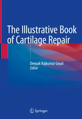 Goyal |  The Illustrative Book of Cartilage Repair | eBook | Sack Fachmedien