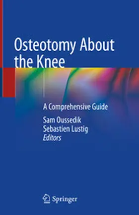Oussedik / Lustig | Osteotomy About the Knee | E-Book | www.sack.de