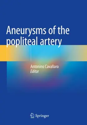 Cavallaro |  Aneurysms of the Popliteal Artery | Buch |  Sack Fachmedien