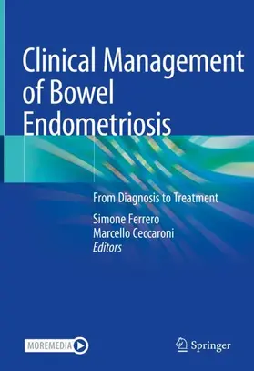 Ceccaroni / Ferrero |  Clinical Management of Bowel Endometriosis | Buch |  Sack Fachmedien
