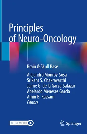 Monroy-Sosa / Chakravarthi / de la Garza-Salazar |  Principles of Neuro-Oncology | Buch |  Sack Fachmedien