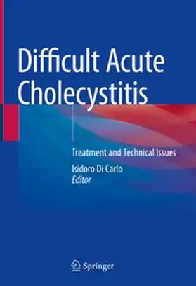 Di Carlo |  Difficult Acute Cholecystitis | eBook | Sack Fachmedien