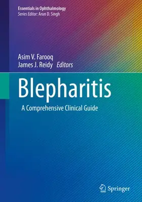 Reidy / Farooq |  Blepharitis | Buch |  Sack Fachmedien