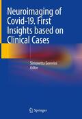 Gerevini M.D. |  Neuroimaging of Covid-19. First Insights based on Clinical Cases | eBook | Sack Fachmedien