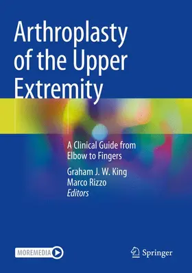 Rizzo / King |  Arthroplasty of the Upper Extremity | Buch |  Sack Fachmedien