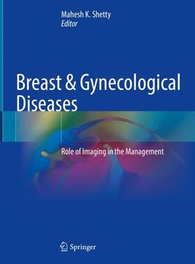 Shetty | Breast & Gynecological Diseases | Buch | sack.de