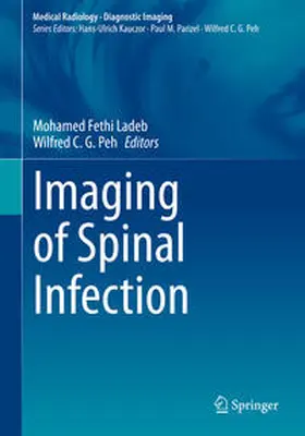 Ladeb / Peh |  Imaging of Spinal Infection | eBook | Sack Fachmedien