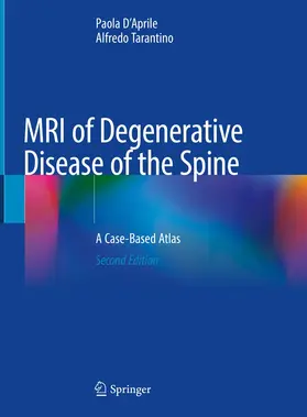 Tarantino / D'Aprile | MRI of Degenerative Disease of the Spine | Buch | 978-3-030-73706-1 | sack.de