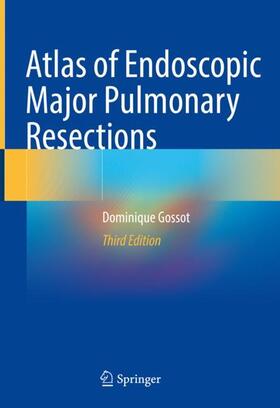 Gossot | Atlas of Endoscopic Major Pulmonary Resections | Buch | sack.de