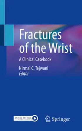 Tejwani | Fractures of the Wrist | Buch | 978-3-030-74292-8 | sack.de
