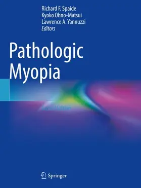 Spaide / Yannuzzi / Ohno-Matsui |  Pathologic Myopia | Buch |  Sack Fachmedien
