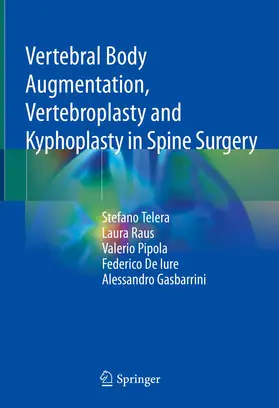 Telera / Raus / Gasbarrini |  Vertebral Body Augmentation, Vertebroplasty and Kyphoplasty in Spine Surgery | Buch |  Sack Fachmedien