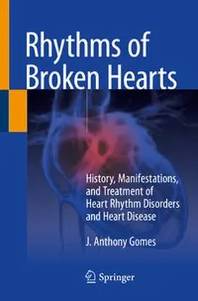 Gomes |  Rhythms of Broken Hearts | eBook | Sack Fachmedien