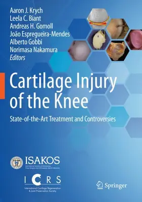 Krych / Biant / Nakamura |  Cartilage Injury of the Knee | Buch |  Sack Fachmedien