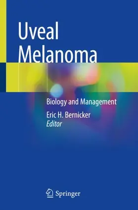 Bernicker |  Uveal Melanoma | Buch |  Sack Fachmedien