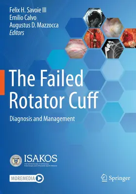 Savoie III / Mazzocca / Calvo |  The Failed Rotator Cuff | Buch |  Sack Fachmedien