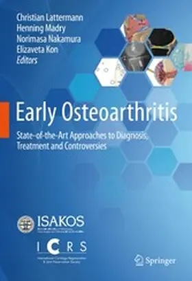 Lattermann / Madry / Nakamura |  Early Osteoarthritis | eBook | Sack Fachmedien