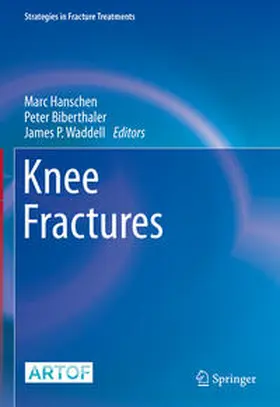 Hanschen / Waddell / Biberthaler |  Knee Fractures | Buch |  Sack Fachmedien