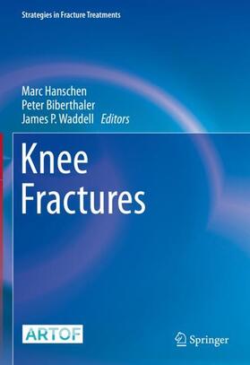 Hanschen / Waddell / Biberthaler | Knee Fractures | Buch | 978-3-030-81775-6 | sack.de