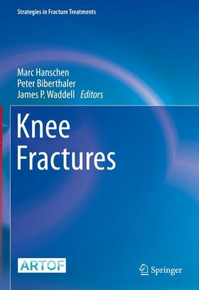 Hanschen / Biberthaler / Waddell | Knee Fractures | E-Book | sack.de