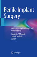 Miranda / Mulhall |  Penile Implant Surgery | eBook | Sack Fachmedien
