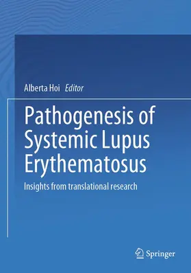 Hoi | Pathogenesis of Systemic Lupus Erythematosus | E-Book | www.sack.de