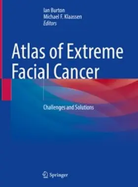 Burton / Klaassen |  Atlas of Extreme Facial Cancer | eBook | Sack Fachmedien