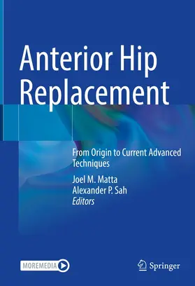 Matta / Sah |  Anterior Hip Replacement | eBook | Sack Fachmedien