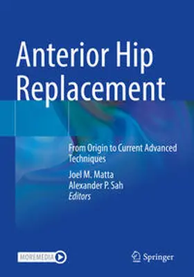 Sah / Matta | Anterior Hip Replacement | Buch | 978-3-030-91898-9 | www.sack.de