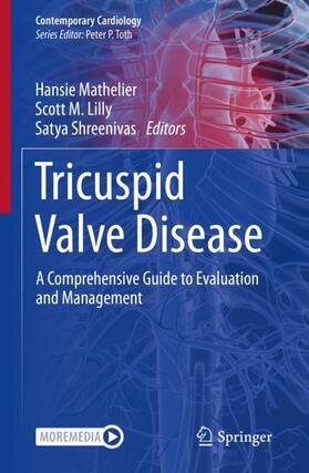 Mathelier / Shreenivas / Lilly |  Tricuspid Valve Disease | Buch |  Sack Fachmedien