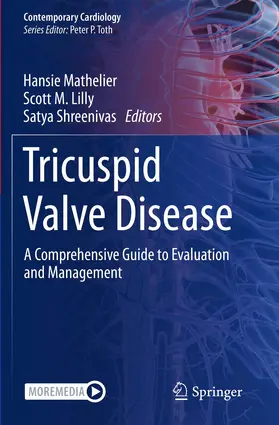 Mathelier / Lilly / Shreenivas |  Tricuspid Valve Disease | Buch |  Sack Fachmedien