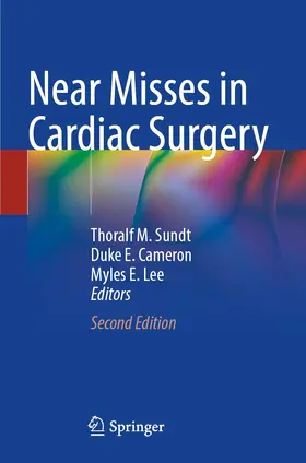 Sundt / Cameron / Lee |  Near Misses in Cardiac Surgery | Buch |  Sack Fachmedien