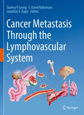 Leong / Nathanson / Zager |  Cancer Metastasis Through the Lymphovascular System | eBook | Sack Fachmedien