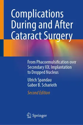 Spandau / Scharioth |  Complications During and After Cataract Surgery | Buch |  Sack Fachmedien