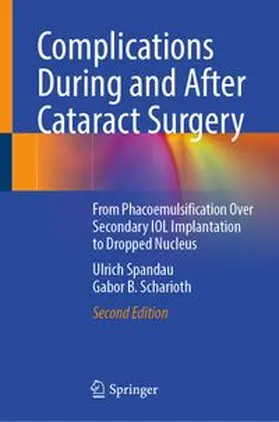 Spandau / Scharioth | Complications During and After Cataract Surgery | E-Book | www.sack.de