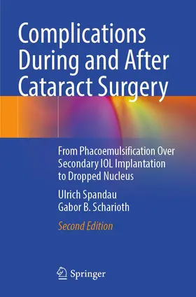 Spandau / Scharioth |  Complications During and After Cataract Surgery | Buch |  Sack Fachmedien