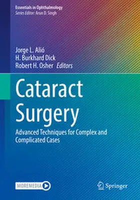 Alió / Dick / Osher |  Cataract Surgery | Buch |  Sack Fachmedien