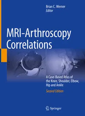 Werner |  MRI-Arthroscopy Correlations | Buch |  Sack Fachmedien