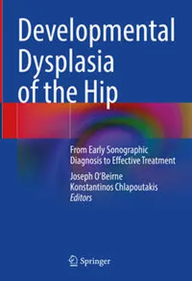 O'Beirne / Chlapoutakis | Developmental Dysplasia of the Hip | E-Book | sack.de