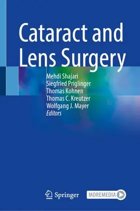 Shajari / Priglinger / Mayer |  Cataract and Lens Surgery | Buch |  Sack Fachmedien