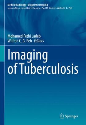 Peh / Ladeb |  Imaging of Tuberculosis | Buch |  Sack Fachmedien