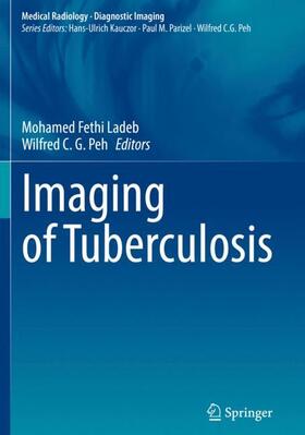 Peh / Ladeb | Imaging of Tuberculosis | Buch | 978-3-031-07042-6 | sack.de