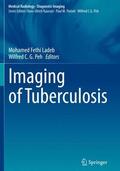 Peh / Ladeb |  Imaging of Tuberculosis | Buch |  Sack Fachmedien