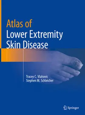 Schleicher / Vlahovic |  Atlas of Lower Extremity Skin Disease | Buch |  Sack Fachmedien