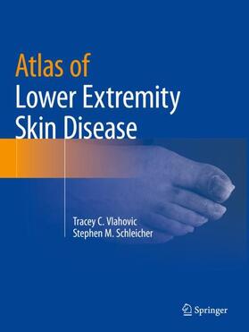 Schleicher / Vlahovic |  Atlas of Lower Extremity Skin Disease | Buch |  Sack Fachmedien
