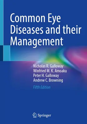 Galloway / Amoaku / Browning |  Common Eye Diseases and their Management | Buch |  Sack Fachmedien