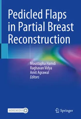 Hamdi / Vidya / Agrawal |  Pedicled Flaps in Partial Breast Reconstruction | Buch |  Sack Fachmedien