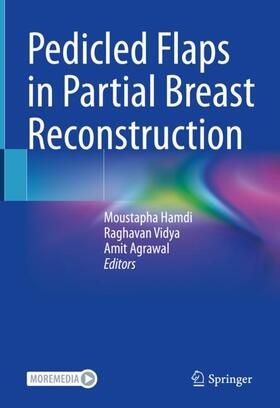 Hamdi / Agrawal / Vidya | Pedicled Flaps in Partial Breast Reconstruction | Buch | 978-3-031-08482-9 | sack.de